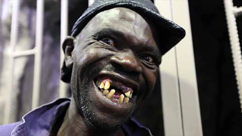 Dünyanın en çirkin insanı hayatını kaybetti