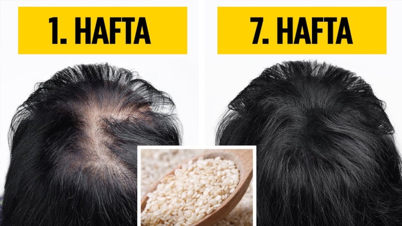 Haftada 2 kez uygulayın, saçlarınız orman gibi olacak