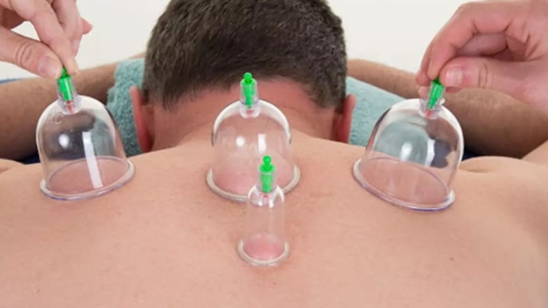 Kafa hacamatının faydaları nelerdir? Hacamat kimlere uygulanmaz?