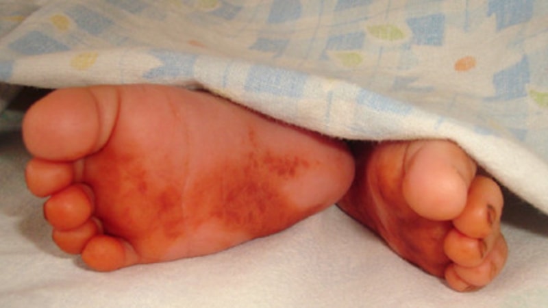 Ayak altına sirkeli kına sürün, gün yüzü görün...