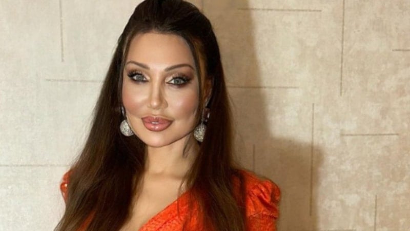 Alın daraltma estetiği yaptıran Umut Akyürek imaj yeniledi! Belgin Doruk'a benzettiler