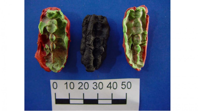 Taş devrinden kalma sakız, dönemin hastalıkları ve beslenme şekillerine ışık tuttu