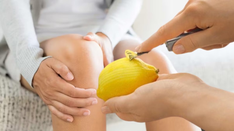 Dizlerinize limon kabuğu sürün, ömür boyu kurtulun
