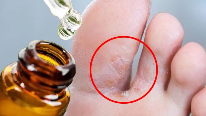 Ayaklarınıza birkaç damla sürün, 20 dakikada şifa bulun...