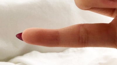 Serçe parmağınız böyle görünüyorsa, geçmiş olsun! İşte hastalığın adı...