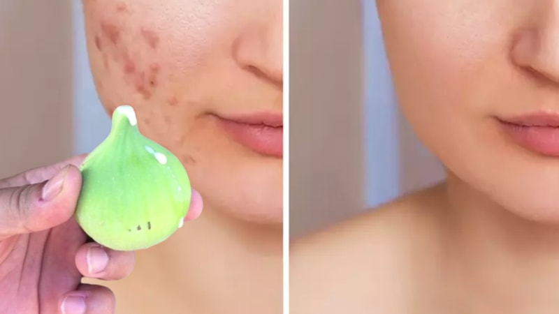 Her gün incir sütü sürün, cildiniz sanat eseri gibi olacak