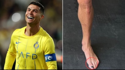 Cristiano Ronaldo neden oje sürüyor? Sebebini duyan şaşıracak...