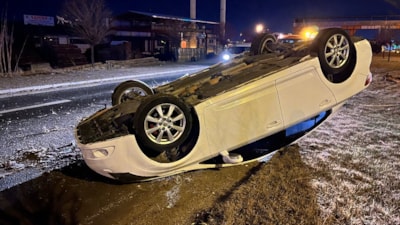 Sivas'ta takla atan otomobilden burnu bile kanamdan çıktı