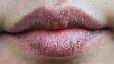 Dudaklarınıza bir kez sürün, ne kuruyacak ne soyulacak...