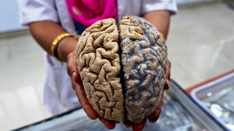 Bir lokma bile yemeyin! Bu besinler beyin sıvısını emiyor...