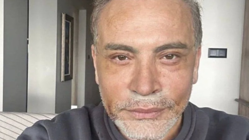 Cenk Eren gerdirdikten sonraki halini paylaştı! O detay dikkat çekti