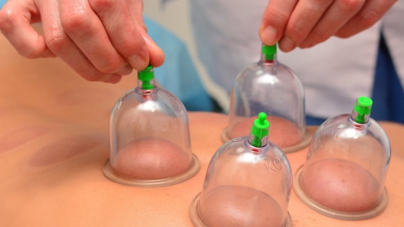 Hacamat nedir? Hacamatın faydaları nelerdir?