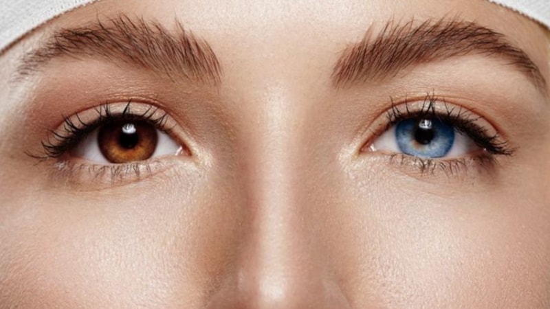 Bu kadarı da pes dedirtti! Göz rengini kahverengiden maviye bakın nasıl çevirtti…