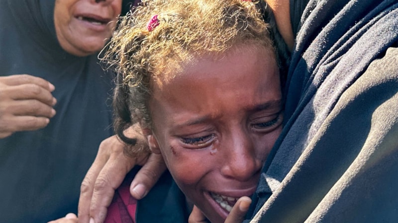 Gazze'de can kaybı 36 bin 731'e çıktı