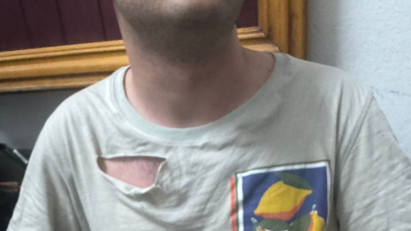 Ankara'da kuduz köpek soruşturmasında muhabire saldırdılar