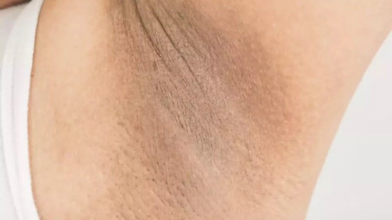 Koltuk altına tuz sürün, yaz boyu o dertten kurtulun...