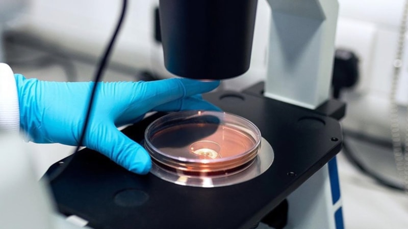 Japonya'da 'et yiyen' STSS bakterisi vaka sayısı yükseldi