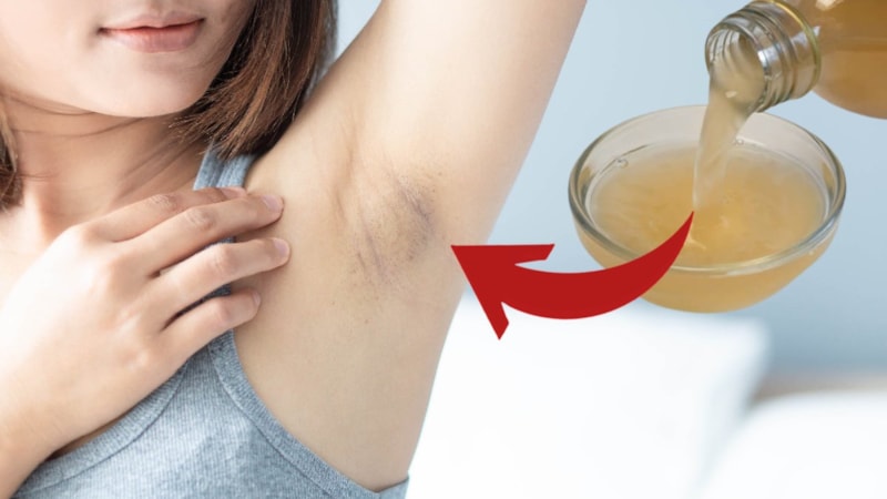 Koltuk altınıza sirke sürün, o derdi tarihe gömün