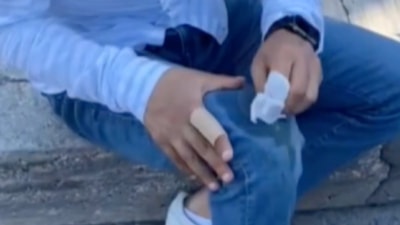 Gaziosmanpaşa'da başıboş pitbull 2 kişiye saldırdı