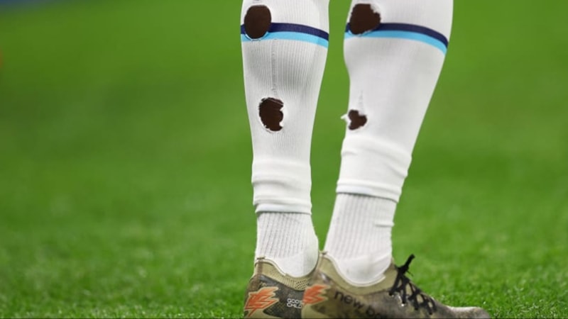 Futbolcuların çoraplarına delik açmalarının nedeni bakın neymiş…