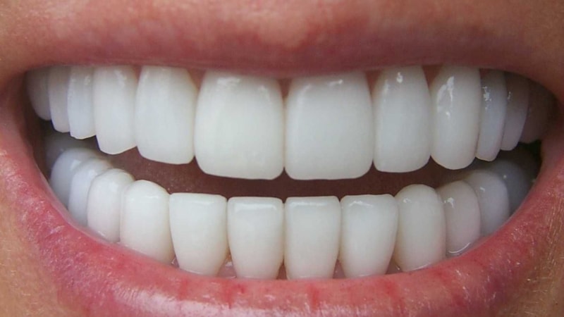 Dişlerinize sürün, fırçayı macunu tarihe gömün! Süt gibi beyazlatıyor...