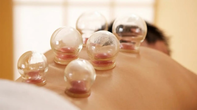 Hacamat takvimi 2024: Temmuz'da sünnet olan günler