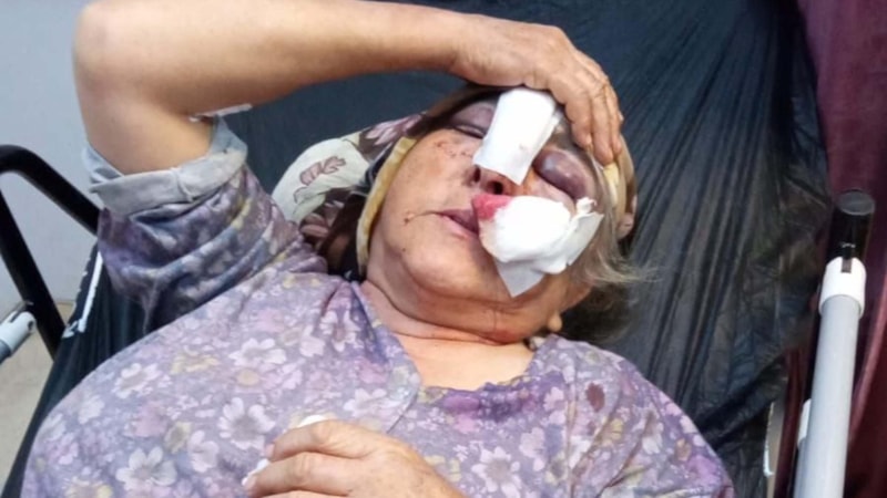 Muğla'da kayınpederini ve kayınvalidesini darbeden damat yakalandı