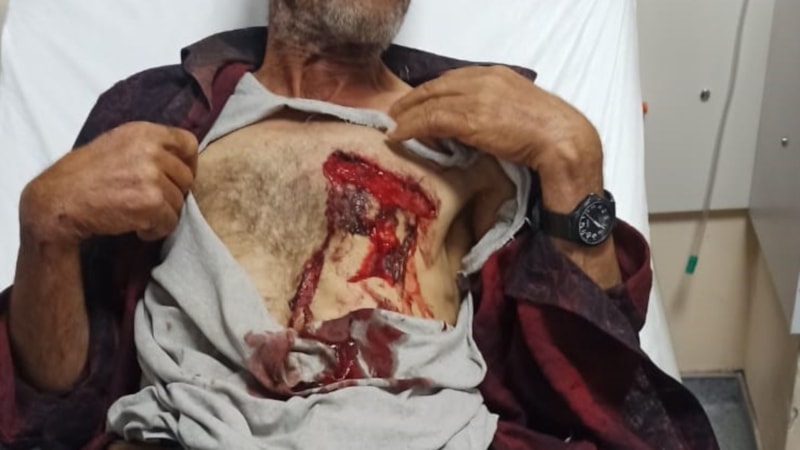 Gümüşhane'de hayvanlarını otlatırken yaban domuzunun saldırısına uğradı