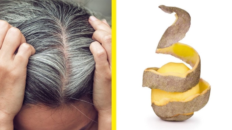 Beyazlayan saçları eski haline döndüren patates kabuğu mucizesi