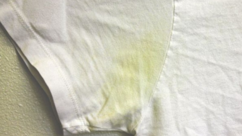 Bu malzeme her evde var: Lekeli bölgeye uygulayın, beyaz tişörtleri kurtarın...