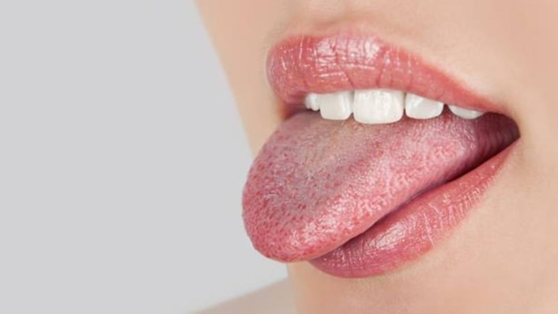 Dil renginize dikkat! Meğer o hastalıkların habercisiymiş...