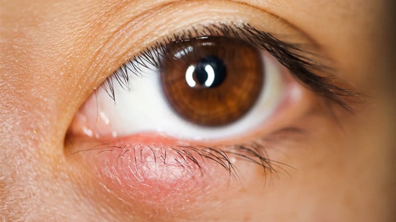 Gözümüzün içindeki delik ne işe yarar?
