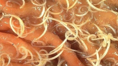 Dikkat! İnsan Cildinde Üreyen 5 Tehlikeli Parazit