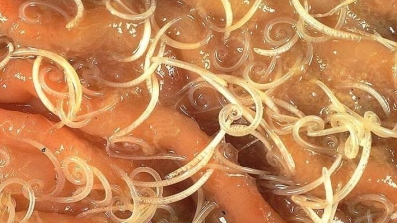 Dikkat! İnsan Cildinde Üreyen 5 Tehlikeli Parazit