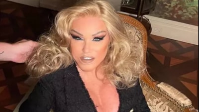 Kedi Kadın Jocelyn Wildenstein'den estetik açıklaması: 