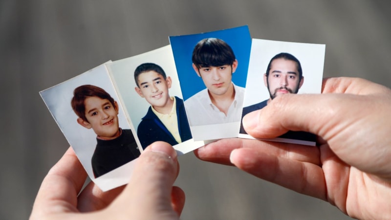 Antalya'da yüzündeki tümör yalnızlığa itti