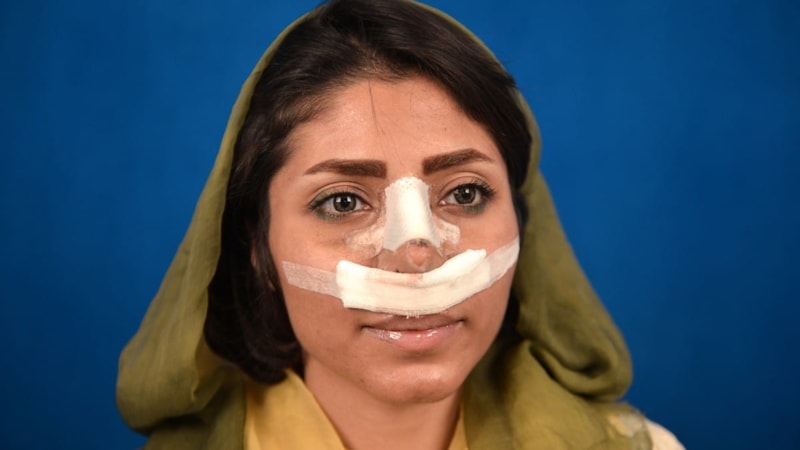 İran'da estetik ameliyat yaşı düşürüldü