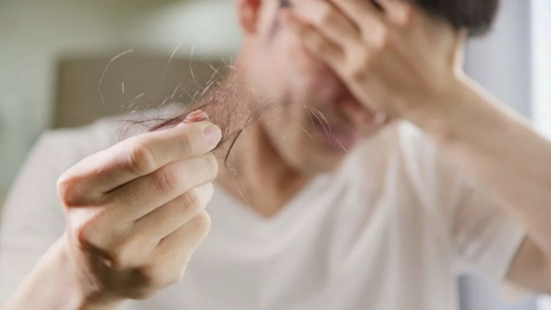 Hindistan'da saç döken gizemli salgın: 155 kişi aniden kel kaldı