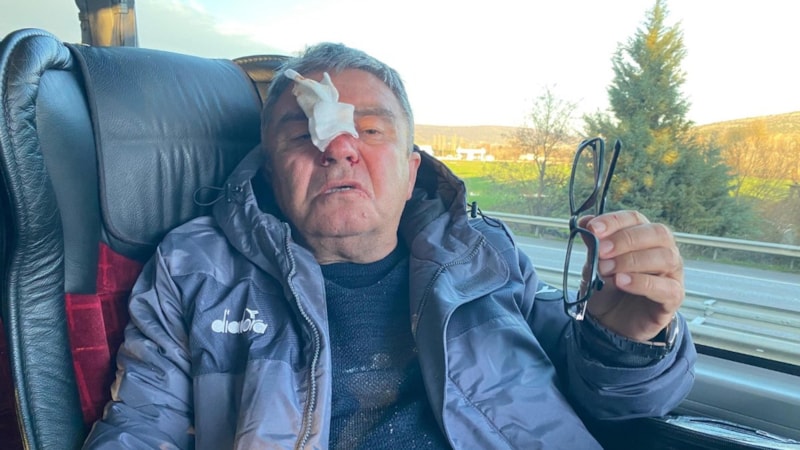 Deplasman dönüşü saldırı! Sportif direktörün burnu kırıldı