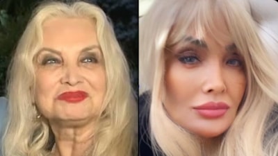 Orhan Gencebay'ın hayat arkadaşı Sevim Emre’den filtre iddialarına cevap verdi: 