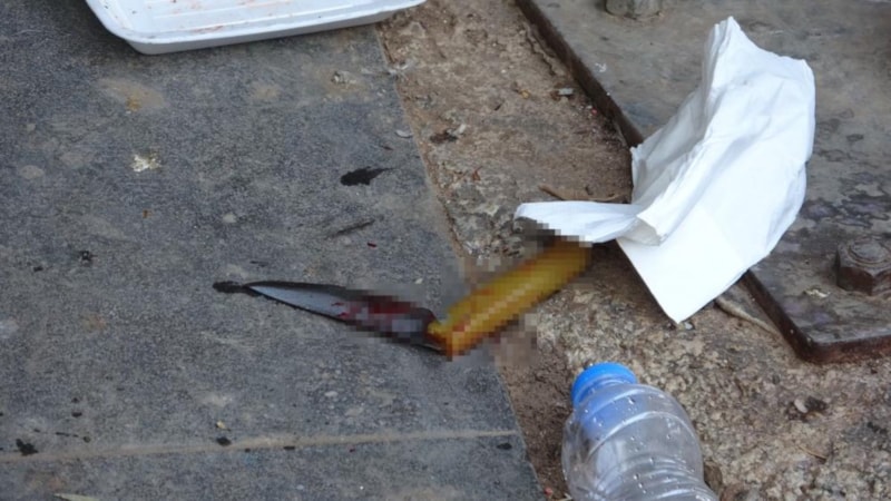 Mersin'de bıçaklı kavgada 2 kişi yaralandı