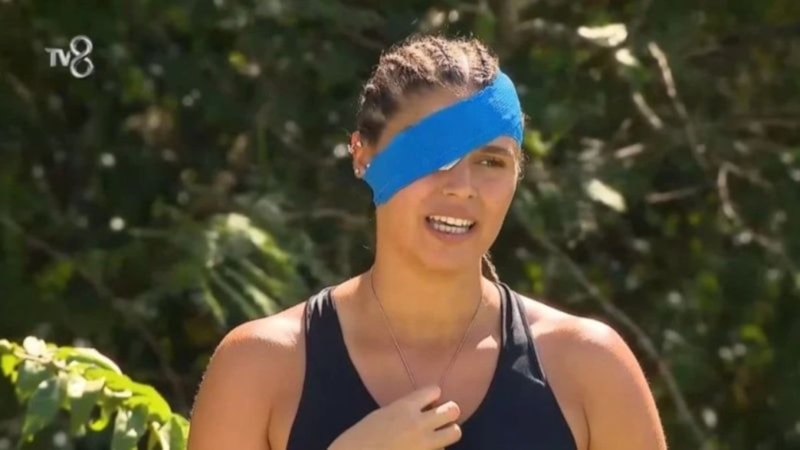 Yüzü gözü yanmıştı; Survivor Ayşe'ye ikinci darbe! Yarışmadan ayrılabilir...