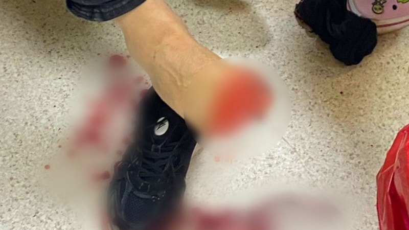 Samsun'da uyuşturucu operasyonunda ateş açılan 2 polis yaralandı