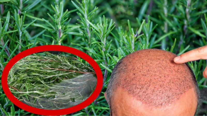 Bu bitkiyi keşfedin, saç ektirmekten vazgeçin...