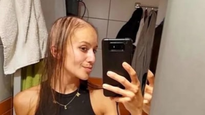 Çekya'da göğüs büyütme ameliyatına girdi: Saçları döküldü