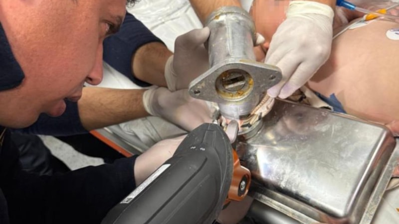 Hatay'da 2 yaşındaki çocuk elini kıyma makinesine kaptırdı