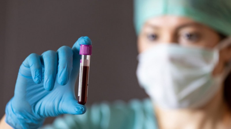 Kan grubunuz sizi genç tutuyor olabilir! Meğer o kan grubu yaşlanmayı geciktiriyormuş