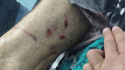 Diyarbakır'da yaşlı adama sokak köpekleri saldırdı