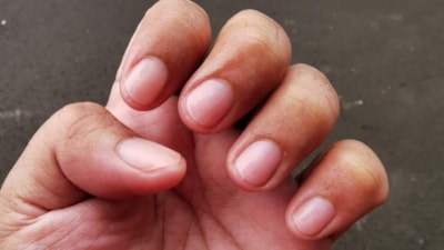 Tırnak şeklinize dikkat: Meğer ne kadar yaşayacağınızı belli ediyormuş