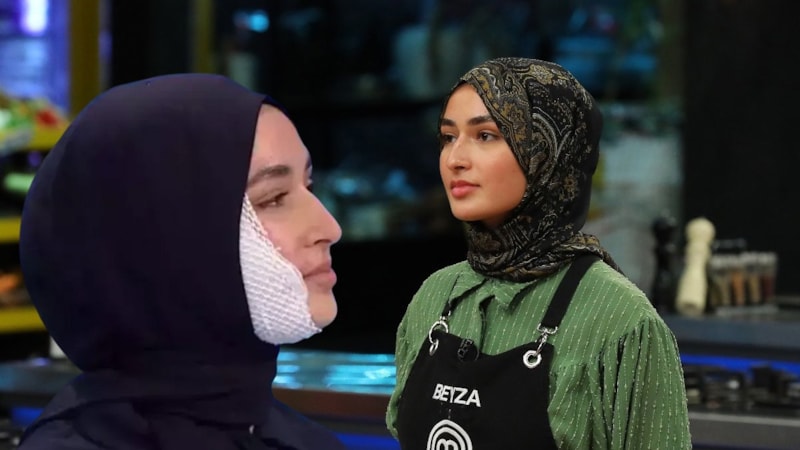 Yüzü yanmıştı! MasterChef Beyza yüzünün yanık halini aylar sonra gösterdi